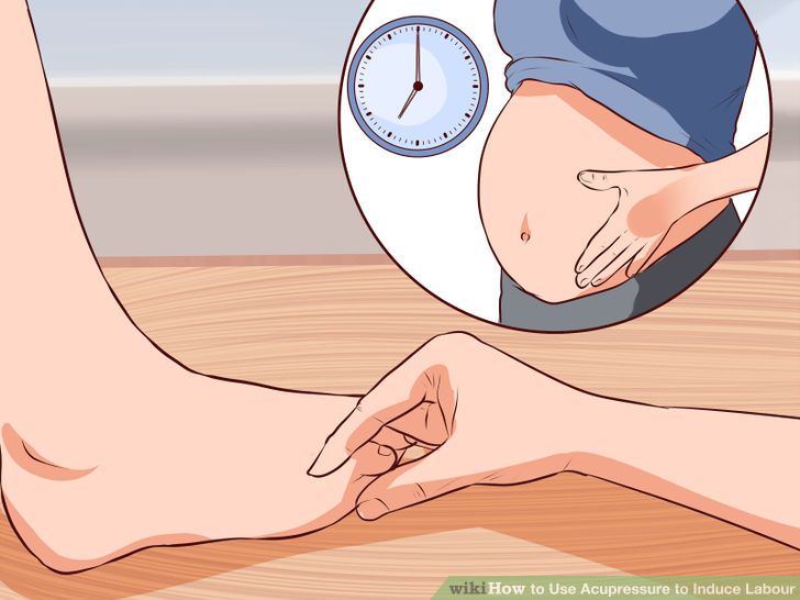 طب سوزنی برای بارداری