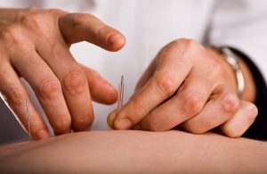 طب سوزنی برای لاغری
