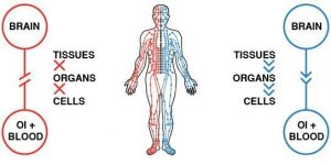 طب سوزنی گردش انرژی و چی در بدن را افزایش می دهد