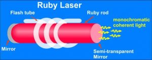انواع لیزر ، لیزر مو های زائد با لیزر روبی