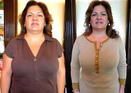 کاهش وزن به کمک طب سوزنی