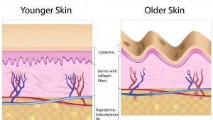 از دیگر ویژگی‌های و برتری‌های کاشتن نخ صورت می‌توان به قابل جذب بودن نخ‌ها و اثراتی که این نخ‌ها می‌توانند در فرایند کلاژن سازی و بازسازی سلول‌های پوست ایجاد کنند، اشاره کرد.