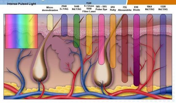 میزان نفوذ لیزر با طول موج های مختلف در پوست