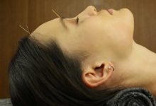 اثرات ماندگار طب سوزنی برای چروک صورت و گردن