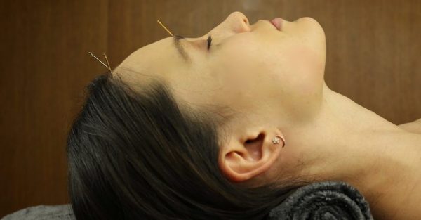اثرات ماندگار طب سوزنی برای چروک صورت و گردن