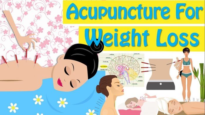 طب سوزنی برای لاغری شکم و پهلو و کاهش وزن