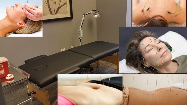 مطب دکتر کتایون عمانیان-دکتر طب سوزنی در تهران