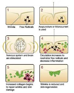 antiaging-acupuncture