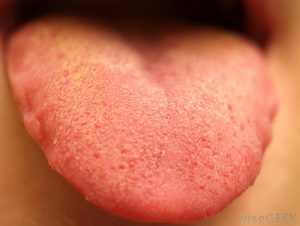 کم آب شدن بدن و خشک شدن زبان