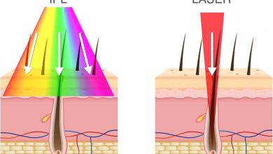 تفاوت لیزر موی زائد با نور شدید پالسی در آی پی ال چیست و کدام موثرترند؟