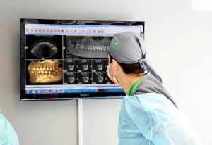 رادیولوژی بررسی استخوان فک جهت کاشت دندان