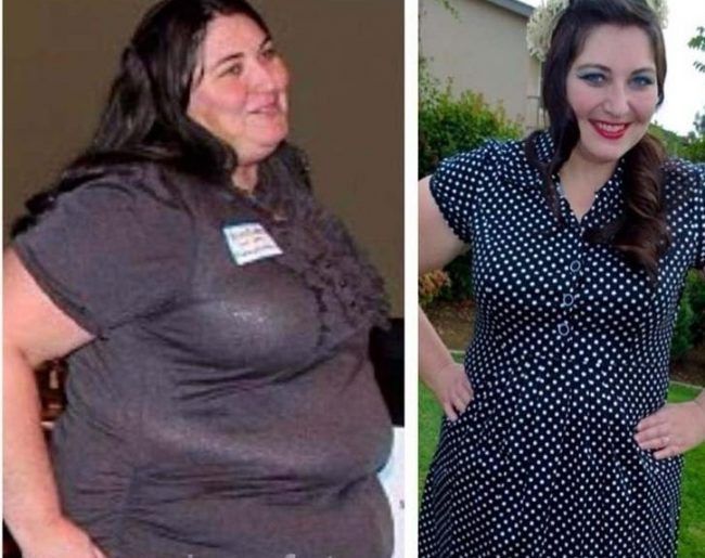 طب سوزنی الکتریکی برای لاغر شدن و چربی سوزی بدن روش مدرن