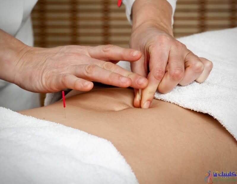 طب سوزنی پزشکی چیست