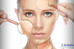 facts-about-collagen1