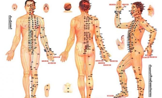 طب سوزنی عضلانی بدن برای تقویت و پرورش عضلات ورزشکاران