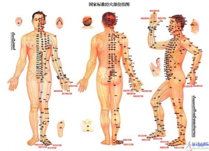 طب سوزنی عضلانی بدن برای تقویت و پرورش عضلات ورزشکاران