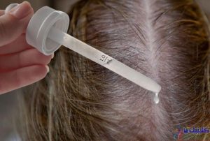 رشد مجدد موها با روش میکروسوزن