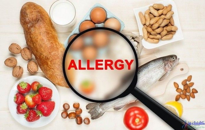حساسیت غذایی