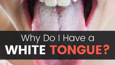 علت زبان سفید رنگ یا سفیدی زبان چیست؟ 10 چاره طبیعی برای رفع آن