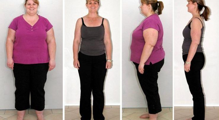 برنامه لاغری و کنترل وزن همزمان با جوانسازی و لیفت پوست و رفع سلولیت پوستی