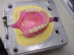 ساخت دندان مصنوعی کامل