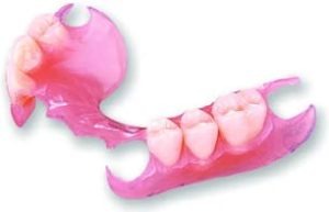 دندان مصنوعی جزئی یا ناقص
