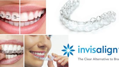 ارتودنسی نامرئی یا ارتودنسی شفاف یا بریس شفاف Invisalign چیست و چه کاربردی دارد؟