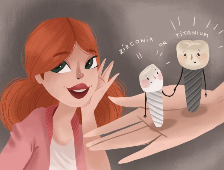 پایه ایمپلنت دندان تیتانیوم در مقایسه با زیرکونیا: کدام یک انتخاب بهتری است؟