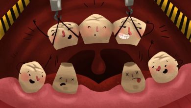 بریج دندان دندانپزشکی: انواع، روش‌ها، هزینه‌ و سوالات متداول