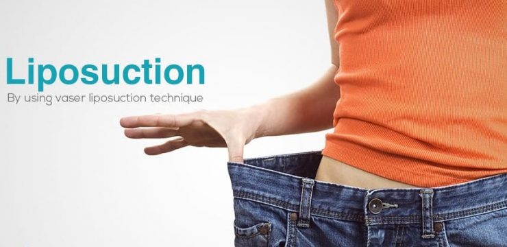 اصلاح و تجدید عمل لیپوساکشن چیست و چه موقع انجام می شود؟