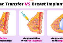 بزرگ کردن سینه و لیفت با پروتز سینه و تزریق چربی: آنچه باید بدانید!؟
