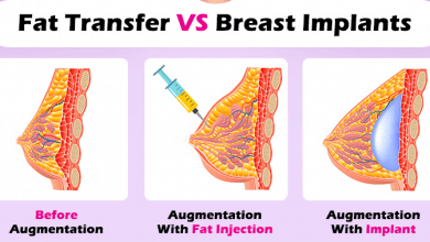 بزرگ کردن سینه و لیفت با پروتز سینه و تزریق چربی: آنچه باید بدانید!؟