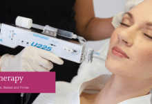 تزریق مزوتراپی از درمان ریزش موی سر تا غبغب : آن چه باید بدانید